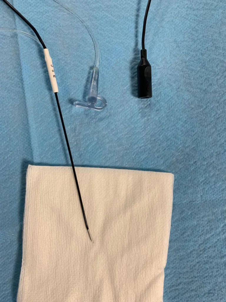 radiofrecuencia del nervio, dolor neuropático