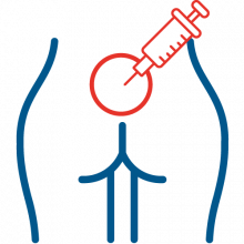 adheriolisis epidural lumbar_ copia